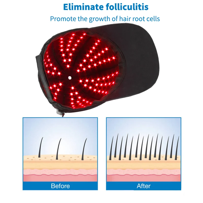 Hot Sale Red Light Therapy Sports Cap 660nm 830nm Infrared Led Lamp Home Use Beauty Equipment Light Therapy Hats Caps