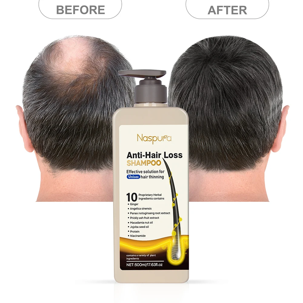 Factory Price Rice Water Shampoo for hair growth shampoo Deep cleansing&Brighten hair shine&for hair growth for black women