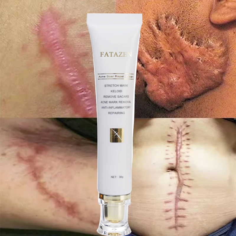FATAZEN Herbal Effective Skin Repairing Gel Natural Acne Pimple Mark Stretch Marks Scar Removing Cream