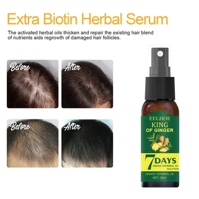 OEM 30ml/50ml EELHOE KING of Ginger Hair Growth Nutrition Liquid Hair Loss Control Hair Spray