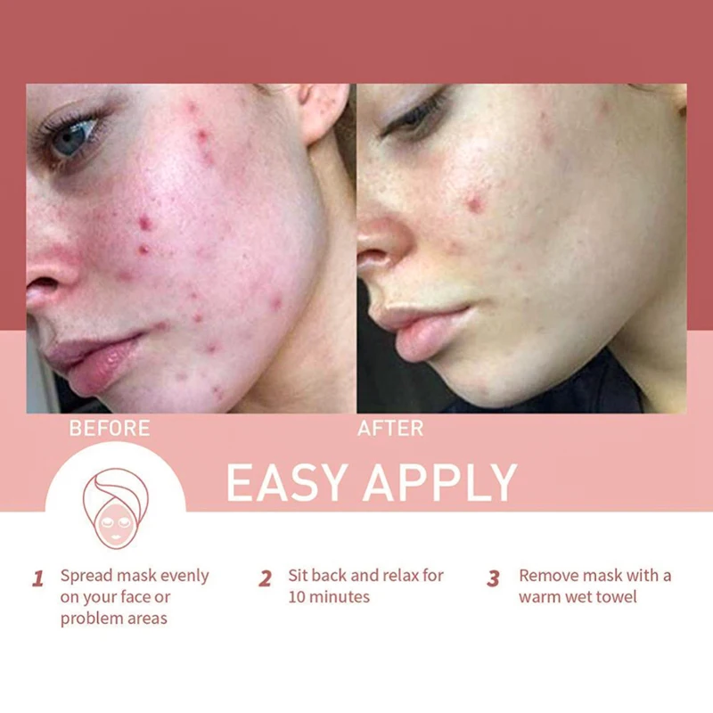 China Factory Own Logo Best Selling Dead Sea Hydrating Deep Cleansing Mud Mask Face Care Mask Facial Mask For Daily Use