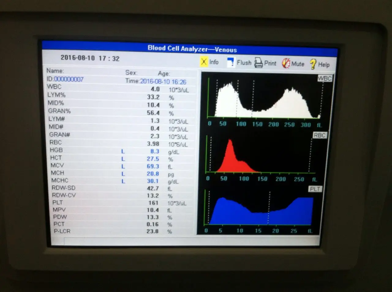 Full auto 3 parts difference hematology analyzer/double channel cbc test machine open to Mindray sysmex reagent system