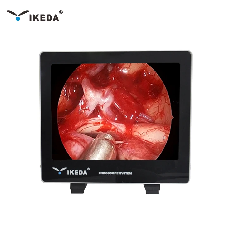 Система камеры SD CCTV