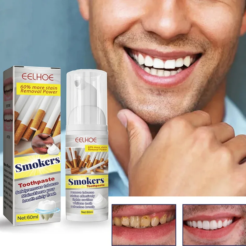 Smokers Toothpaste for Stain Removal and Fresh Breath