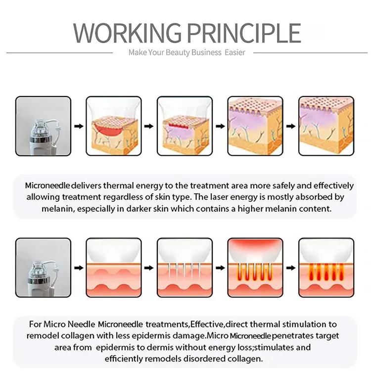2 в 1 комбинированная машина 980nm Диодная сосудистая фракционная rf микроигла