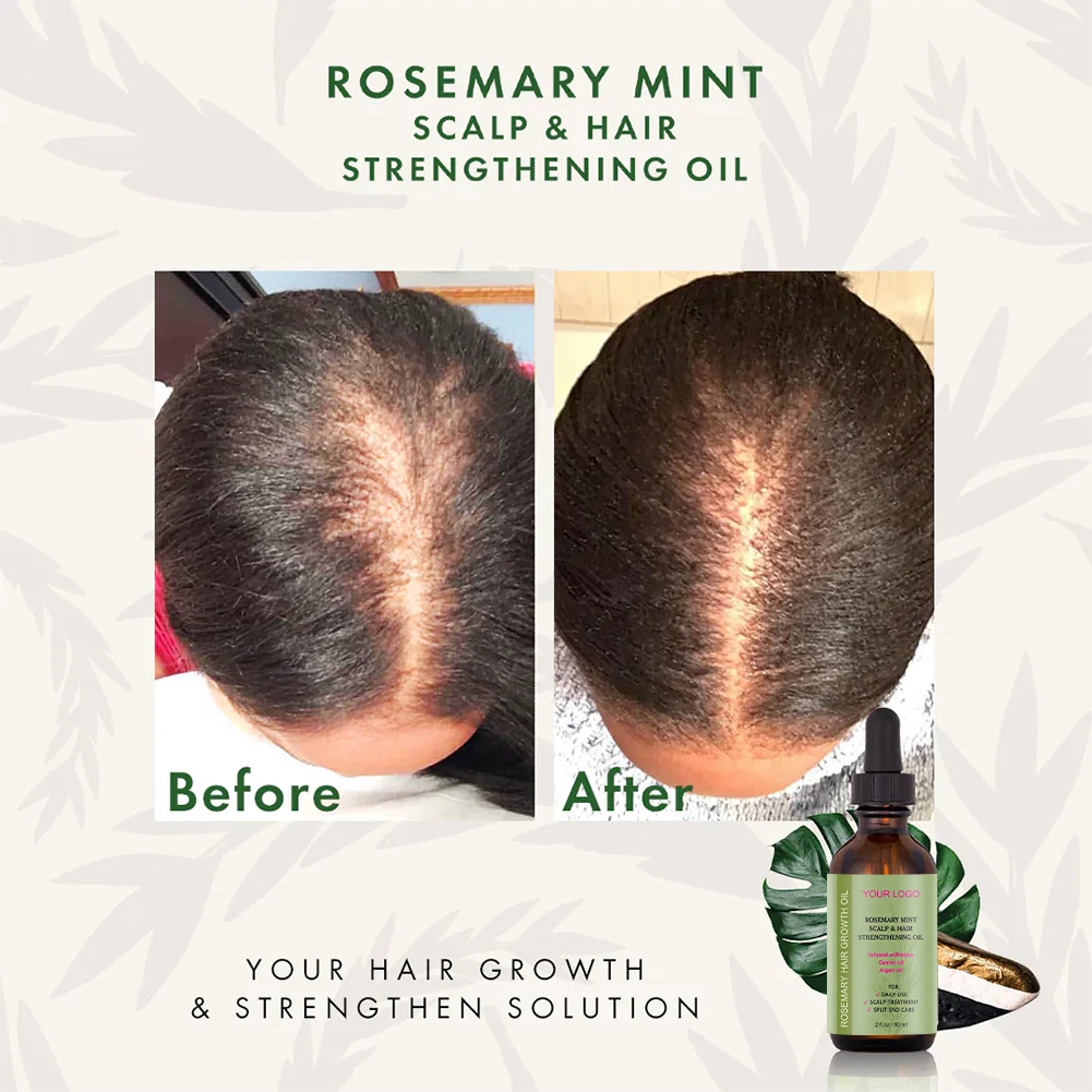 Organic Lavender Rosemary Fast Hair Growth oil for African Alopecia Regrowth Mint Serum for Black Women Hair Loss Product