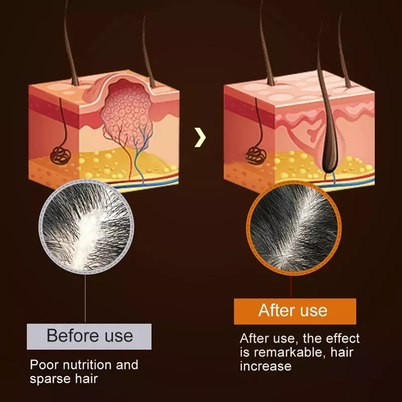 Natural Organic Private Label Vegan Treatment for Baldness Hair Growth Essential Oil Herbal Anti-Hair Loss Hair Growth Oil