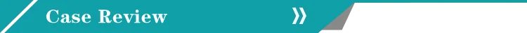case review.png