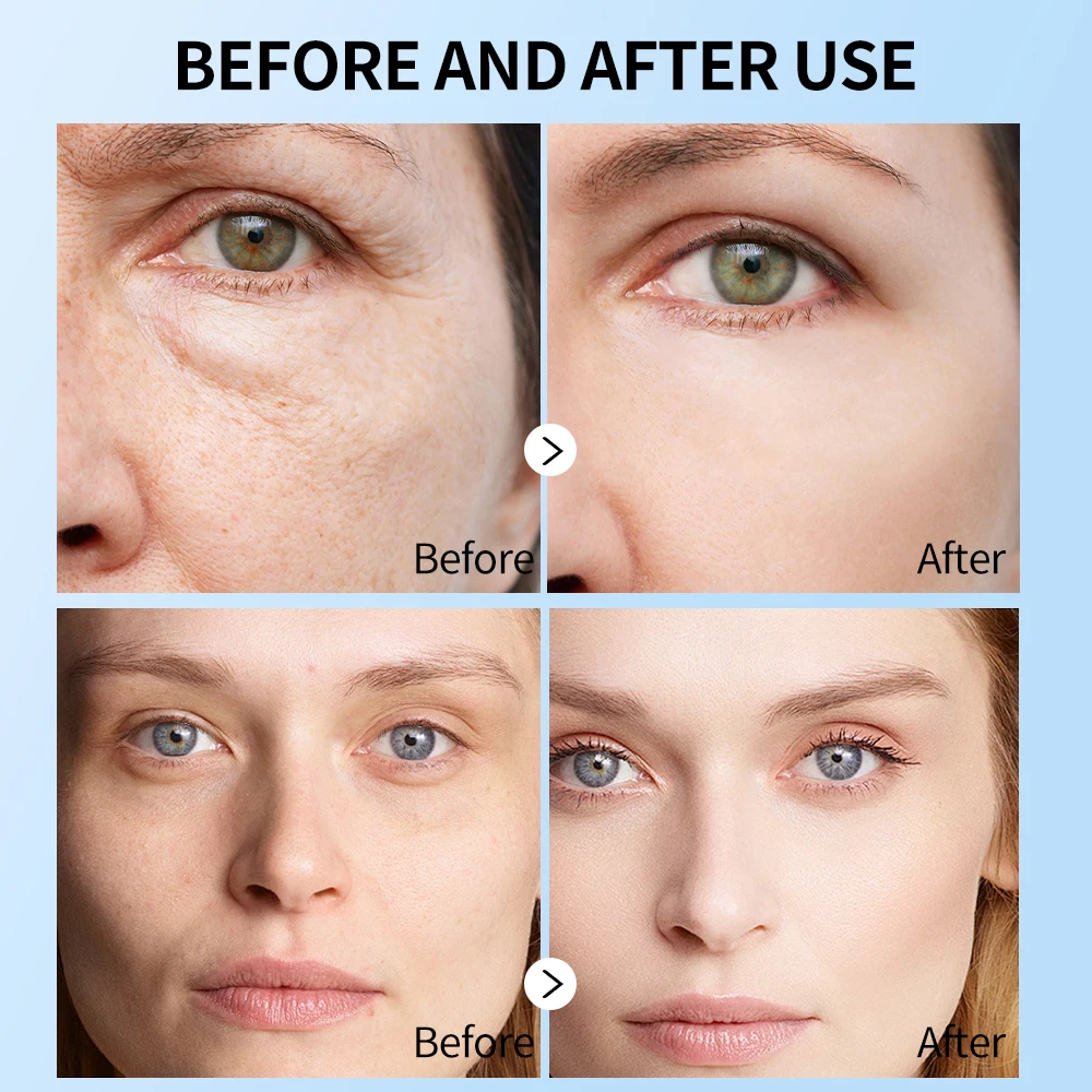 6 Types Capsule Pearl Face Mask Sheet Soothes Skin Moisturizing Whitening Firming Anti Aging 25ml MOOYAM Capsule Facial Mask