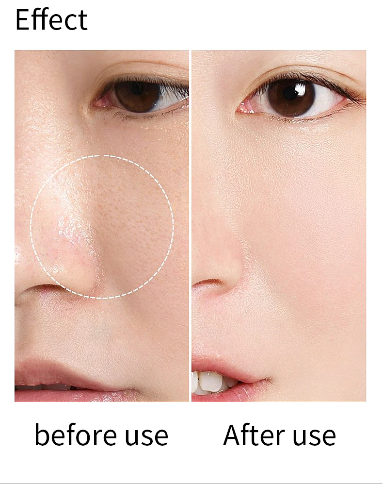 New 3 in1 rf+nano+meso microneedle mesotherapy gun meso injection gun Dermis firming mesotherapy gun vital injector