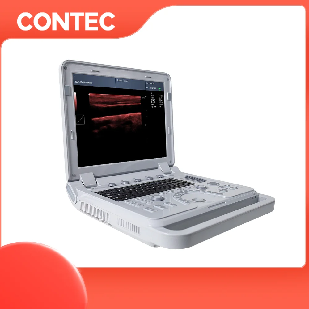 CONTEC CMS1700B portable ultrasound scanner for human being ultrasound transducer ultrasonic machine