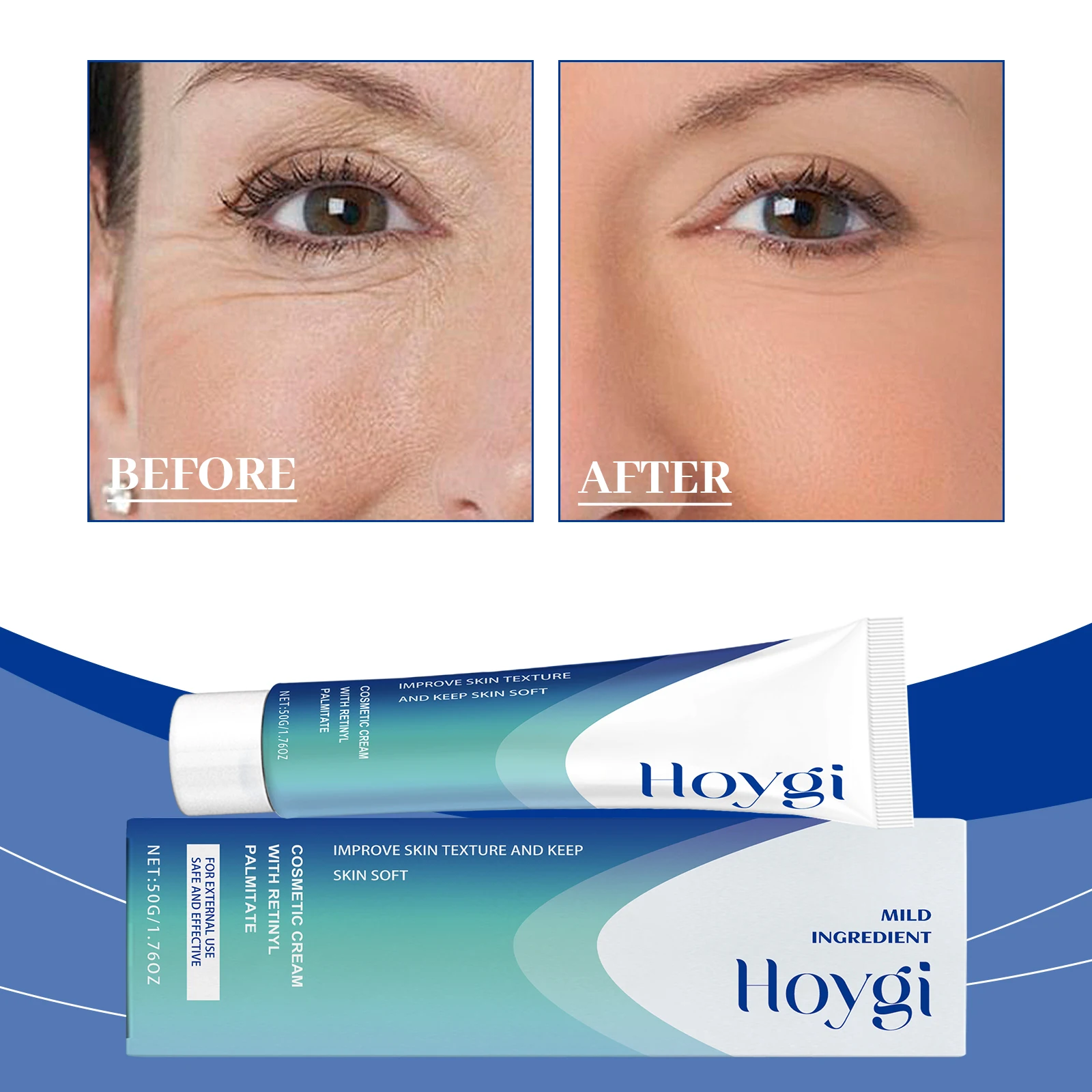 Anti-aging cream is effective in delaying the aging process of the skin