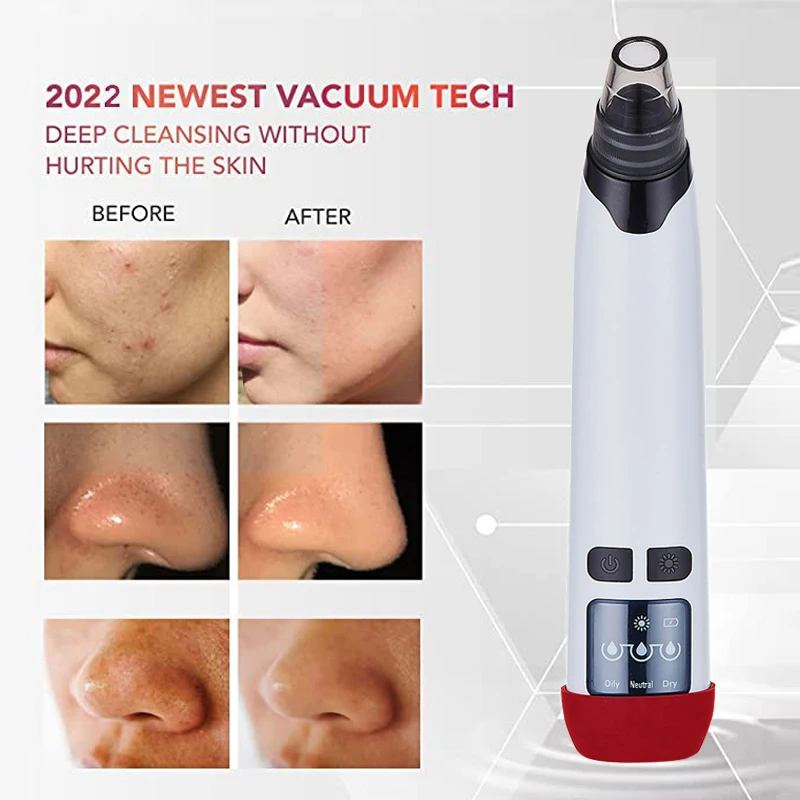 1489 Best Selling Products 2022 In USA Amazon vacuum blackhead remover vacuum cleaner for pores black head machine
