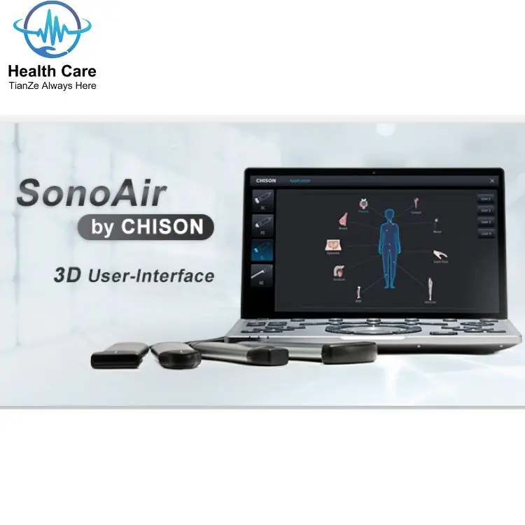 Chison SonoAir 70 Redefine the Future of Portable Ultrasound  perfect combination of powerful and good quality