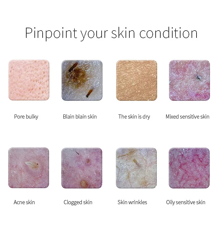 Skin scanner Scalp analyzer HD 50 times software analysis Wireless wifi connection to mobile phone