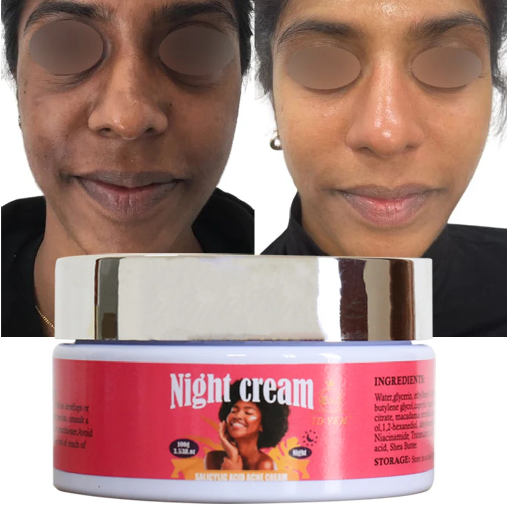 Private label original night cream organic anti aging spot removing acne whitening women night cream
