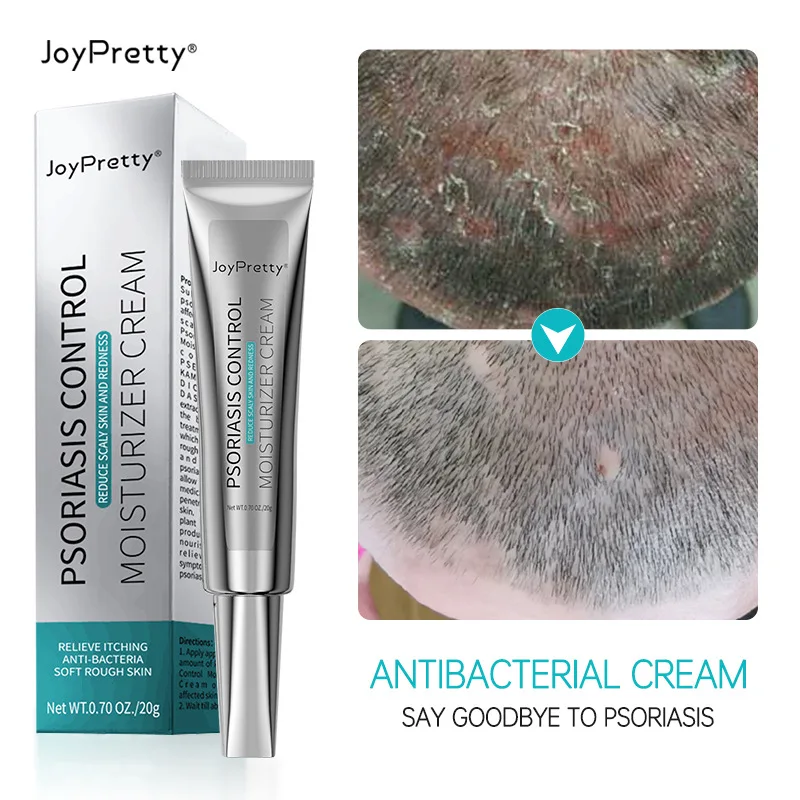 Skin Care Psoriasis Control Reduce Scaly Skin And Redness Moisturizer Cream Skin ringworm King ointment ointment wholesale 20g