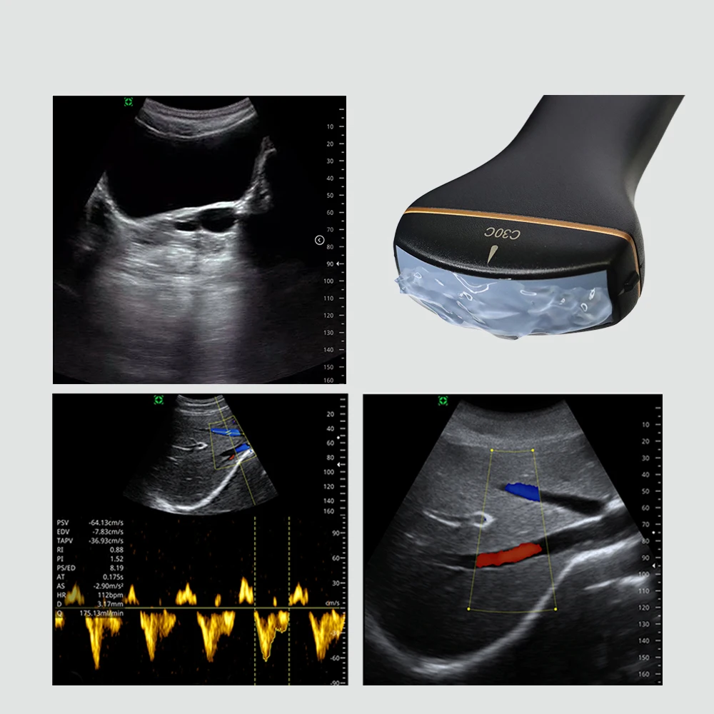 Ultrasonic Linear Probe Wireless Ultrasonic Handheld Ultrasound Scanner for use with mobile phones