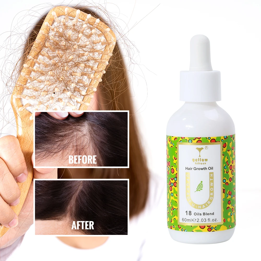 Rosemary Oil Hair Growth Set 7 days ginger Hair Growth Serum 40 ml Ginger Oil Chebe Jamaican Black Castor Oil For Hair Growth