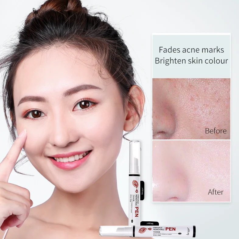 
 Крем против веснушек, крем для лица против веснушек, Лучший Крем Для веснушек  