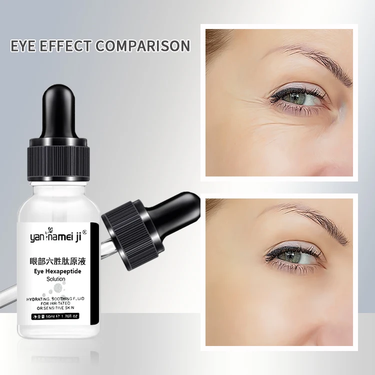 Hot Sale Eye Serum Remove Dark Circles Eye bags Anti-wrinkle Solution For all skin type