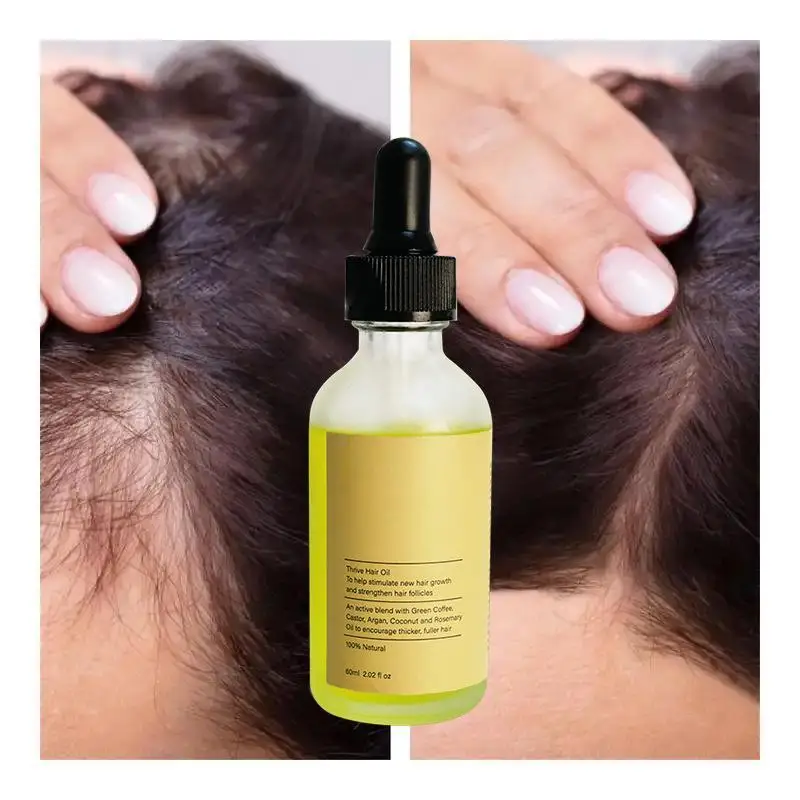 Professional Customization hair regrowth serum loss strengthen hair Powerful Oils Fast Thrive Hair Growth Power Mix Oil