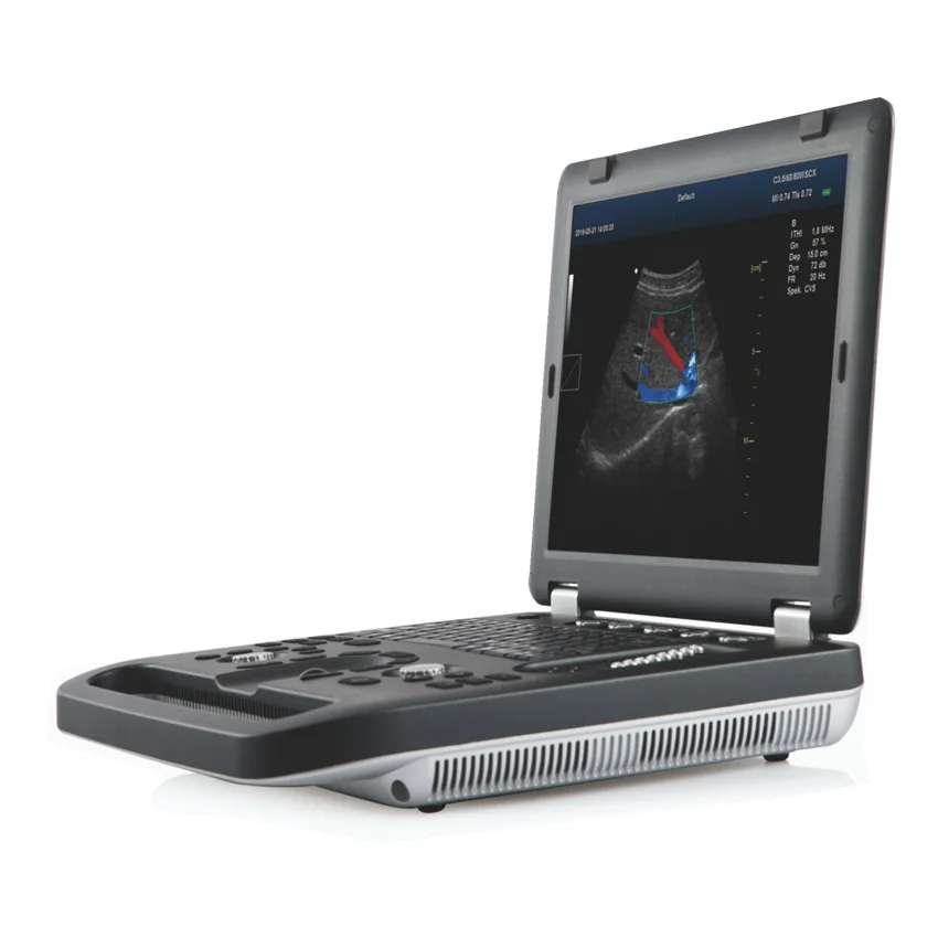  MY-A024F Mayamed all touch-screen color Doppler ультразвуковая система машина с зондами для