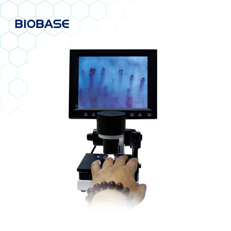BIOBASE China Microcirculation Microscope WXH-8 capillary microscope/darkfield live blood analysis microscope