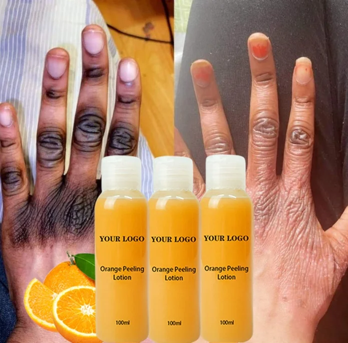Free Sample Whitening Oil Body Care Orange Peeling Lotion Exfoliating Yellow Peeling Oil For Black Skin
