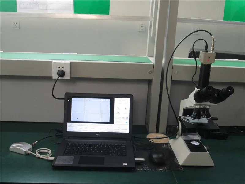 Automatic sperm analyzer/ medical male semen quality measurement equipment