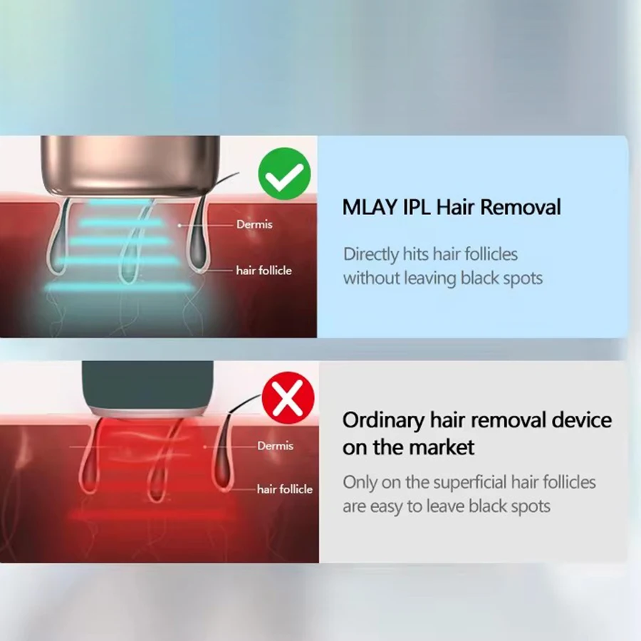 Mlay M3 Mini Home Use IPL Photo Facial Machine Laser Hair Removal for Women Age Spots Removal for Face Use