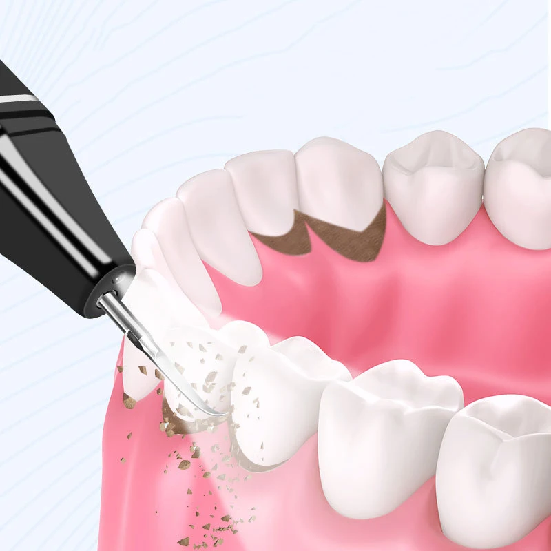 Ultrasonic Electric Tooth Scaler Cleaner with 3 Modes Remover for Teeth 100% Safe