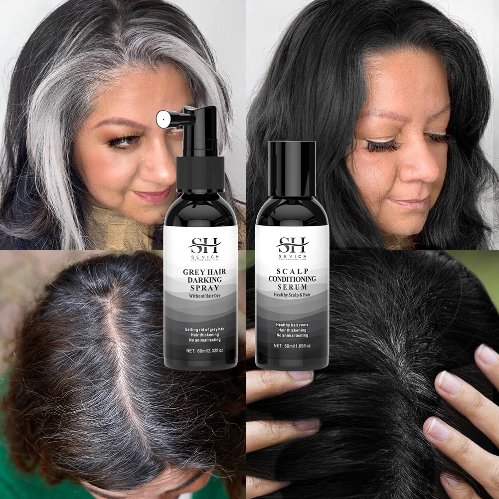 New Arrival Anti Gray Hair Treatment Increase Hair Follicles Melanin Continued Use Gray White Hair To Black Spray