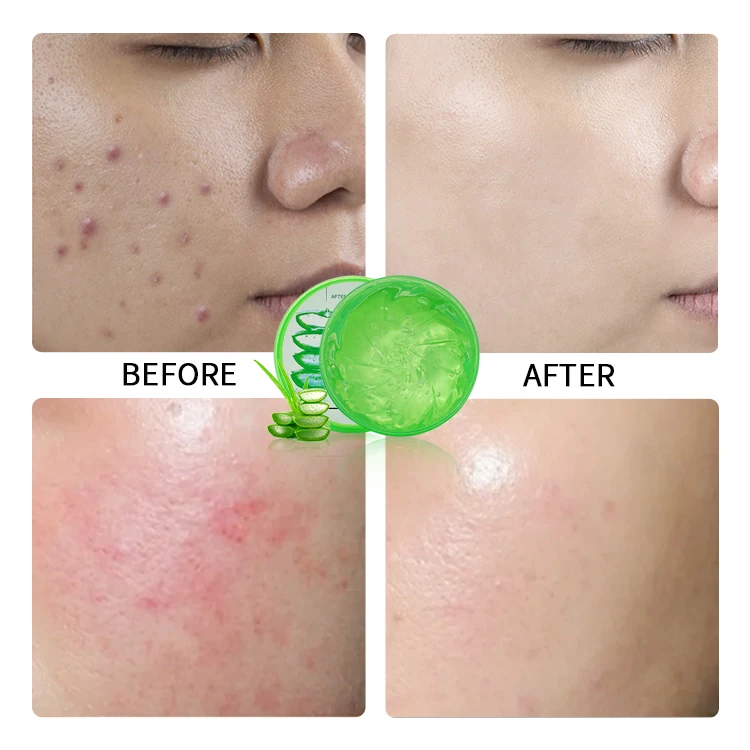 Private Label 100% Natural Moisturizer Repairing After-sun Repair Soothing Organic Bulk Face Care 99% Pure Aloe Vera
