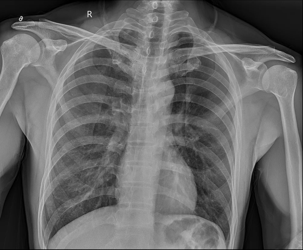 Wired DR Xray Flat Panel Detector for Medical X ray Radiotion Equipment