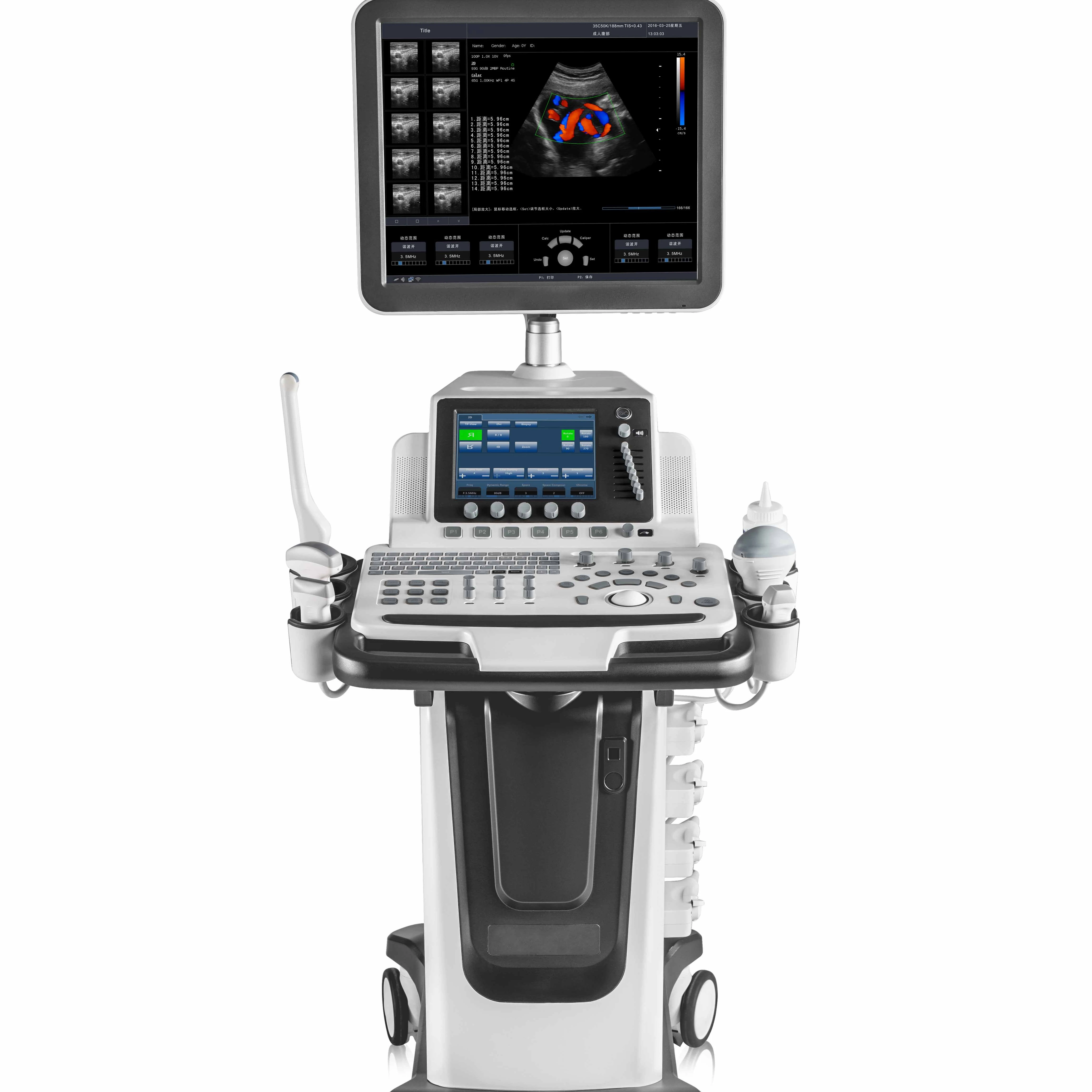 Best sell Trolley 4D Cardiac Probe Color Doppler Ultrasound Machine