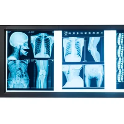 X-ray Viewer Hospital Negatoscope Dental Film Viewing Box Medical Device Adjustable Brightness Illuminator Light Panel Screen