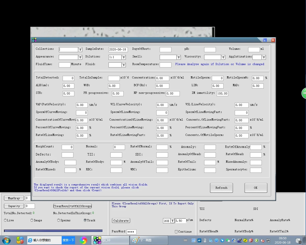 High accuracy Automated Sperm Quality Analysis System/sperm analyzer price/Laptop trolley computer assisted semen analysis