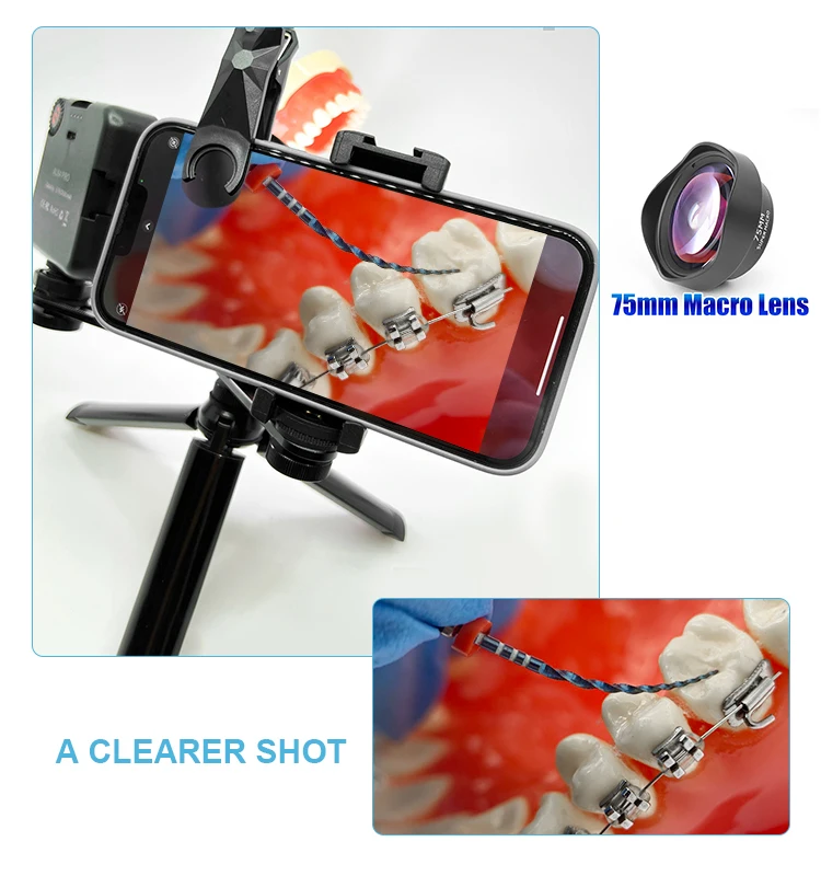 Adjustable Dental Oral Photography Light For Mobile Phone Dental Led Filling Light With Bluetooth