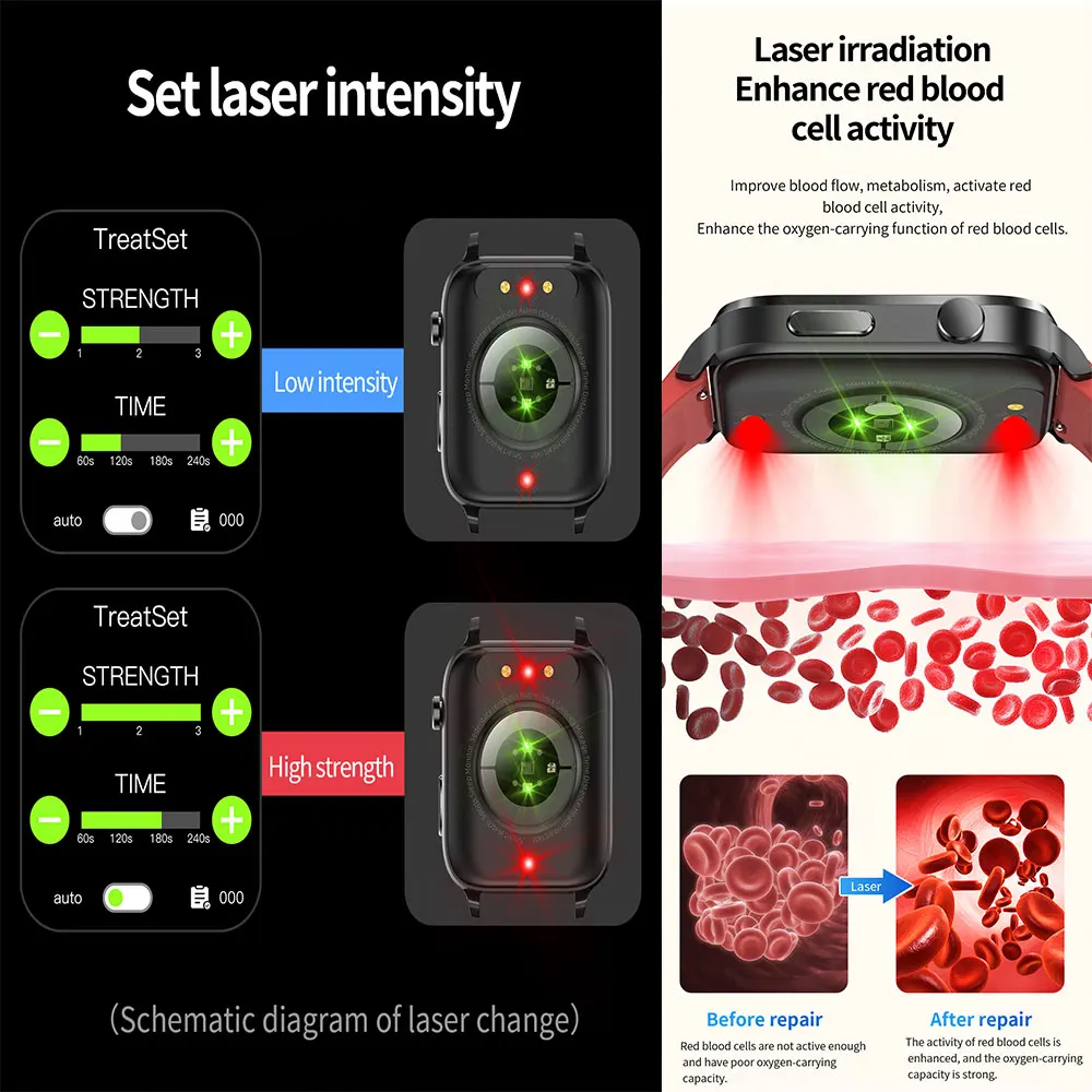 Smart diebetes recover watch 4 colors 650nm amoled laser acupuncture treatment therapeutic health therapy wrist smart watch