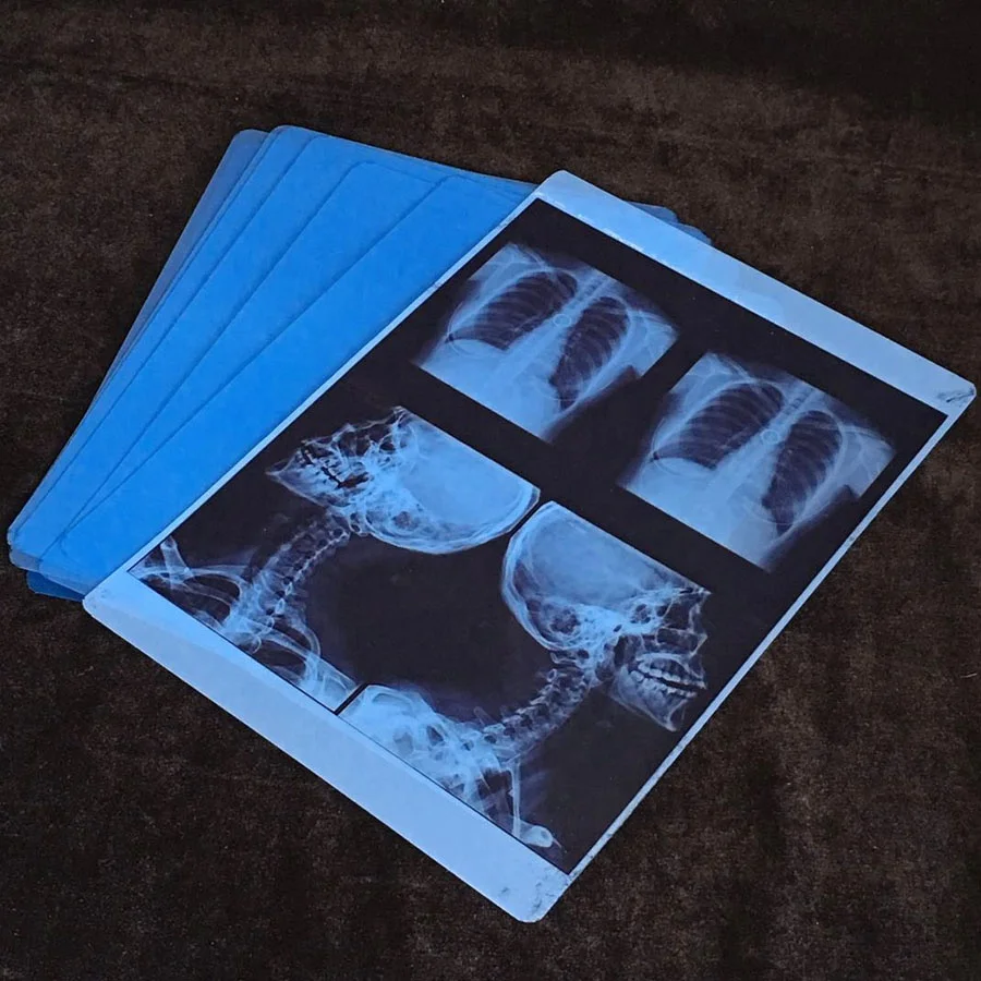 14x17 Inch Inkjet Blue Medical Xray Film in Sheets for CR CT MRI Image