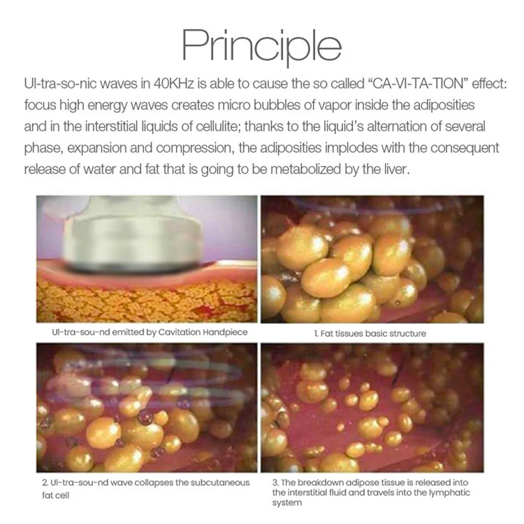 Svatar 2Mhz Double Chin Anti Wrinkle Remove Skin Care Machine Body Slimming Machine 40K