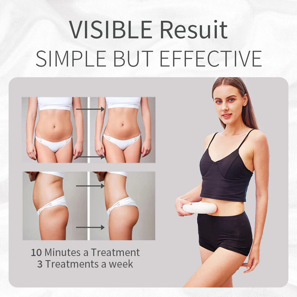 ODM/OEM rf body slimming device body shaping cellulite slimming fat burning stretch mark removal smooth shapes cellulite machine