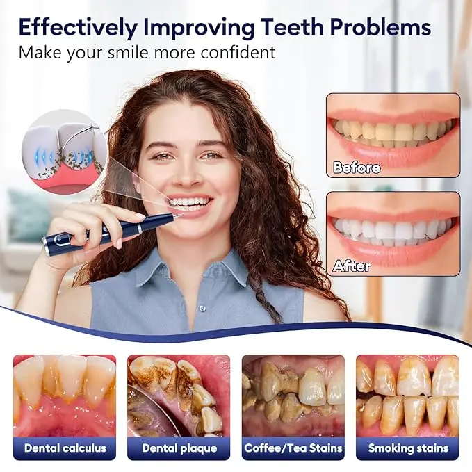 New Trends Product Ultrasonic Dental Scaler Tooth Cleaner Teeth Tartar Plaque Remover For Home Use Dental Tools