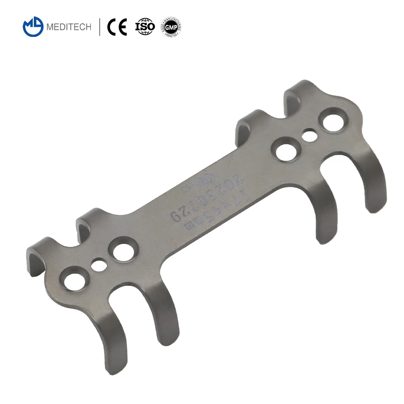 Orthopedic Titanium Patented Rib Bone Plate Ortho Implants For Rib Bone Fracture