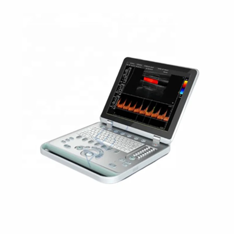 High quality machine color doppler ultrasound ultrasound machine color doppler ultrasound color doppler laptop