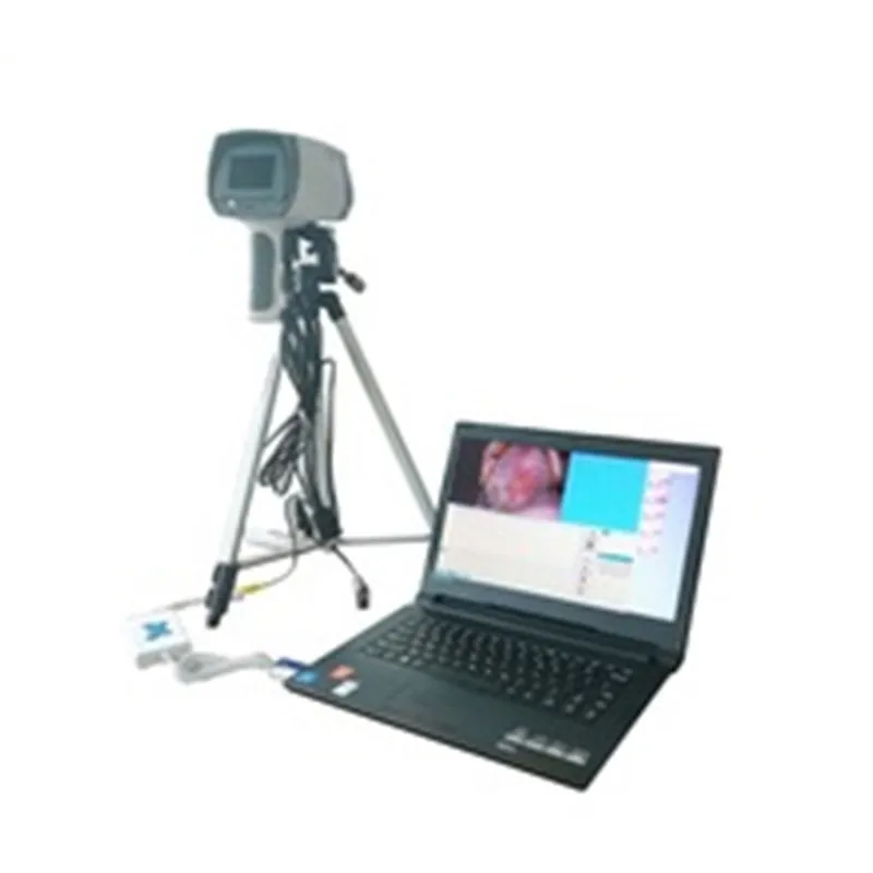 medical devices digital video colposcope used in home or clinic