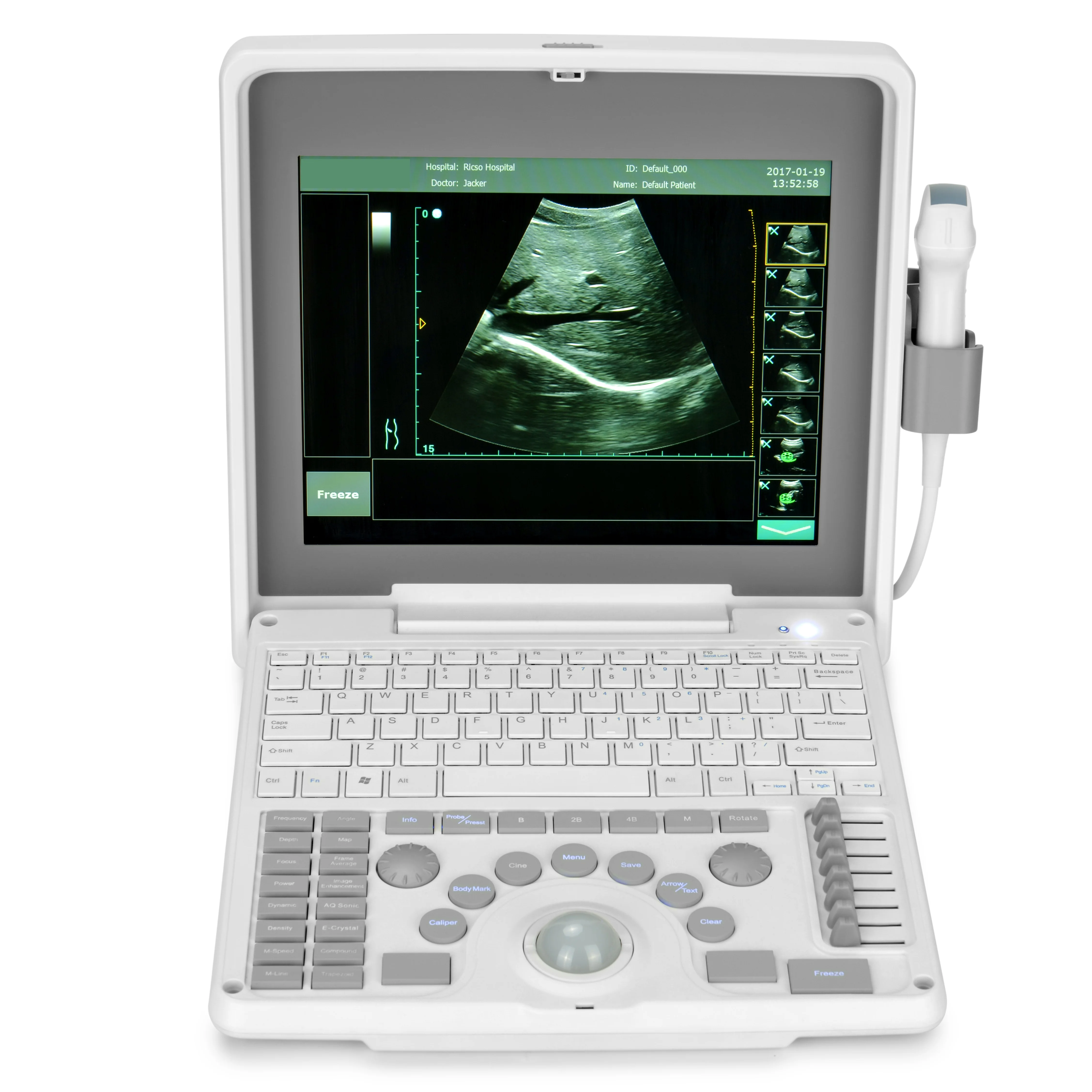 
Portable Digital Laptop Ultrasound Imaging System 