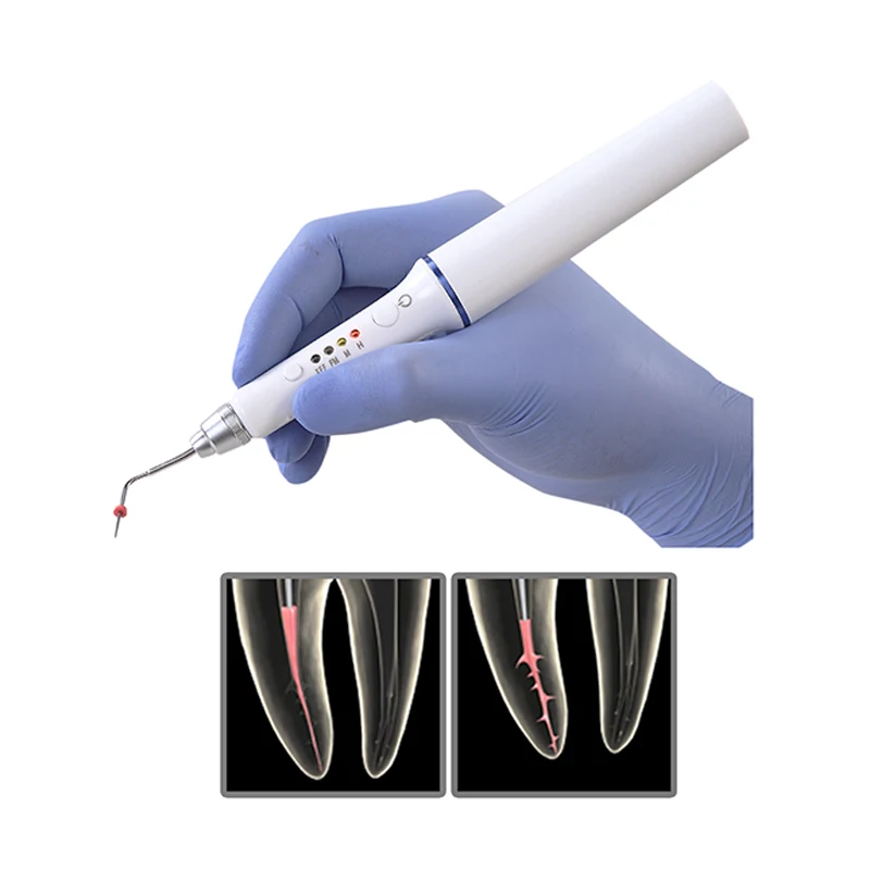 
AKsDenT J1SS Dental Cordless Gutta Percha Obturation System gutta-percha applicator Obturation Pen 