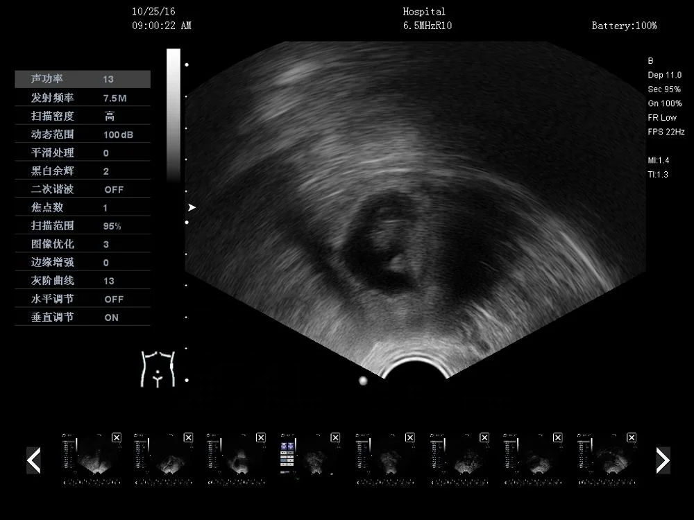 FK2 6 Languages support Portable Color Doppler Ultrasound Scanner